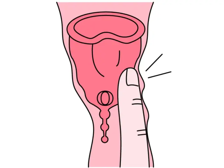 Dłoń naciska na kubeczek menstruacyjny. Tworzywo TPE, choć popularne, może budzić pytania o jego szkodliwość.